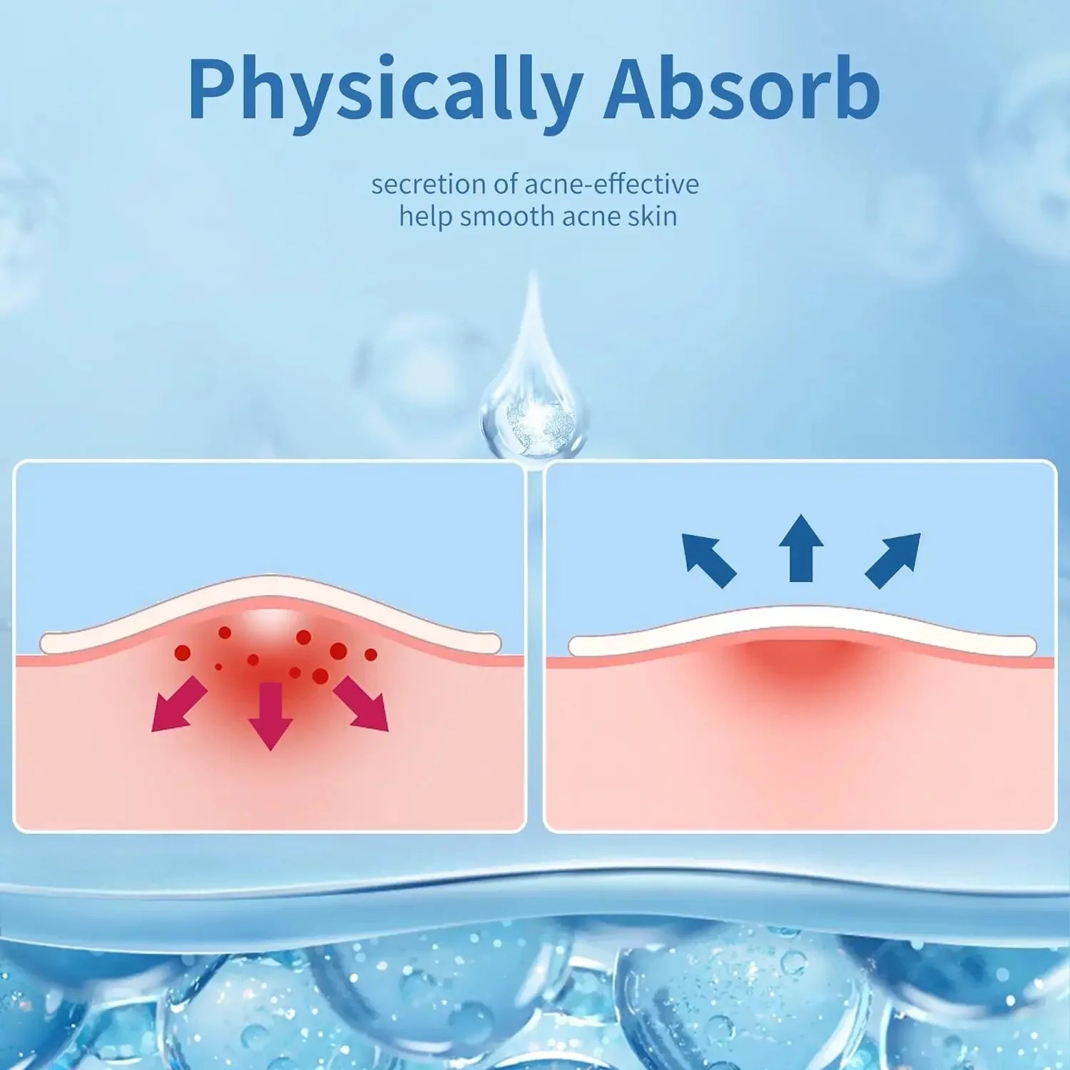 Clear Skin Magic Pimple Patches